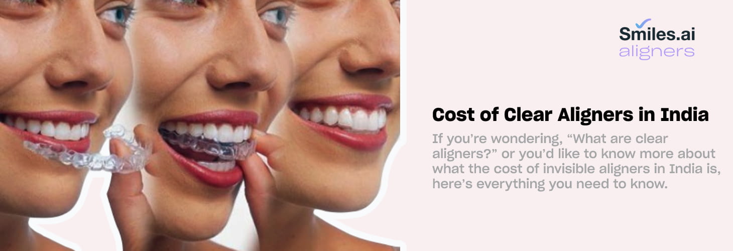 Smiles.ai Aligners cover picture